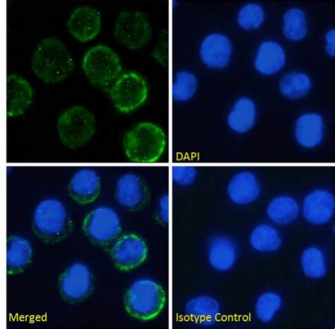 IL6R Antibody (rhPM